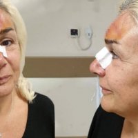 "Kim nazar ediyorsa..."