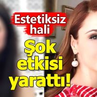 Mine Tugay'ın estetiksiz hali