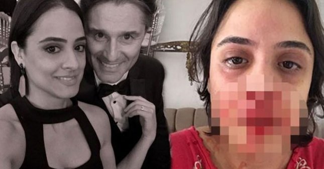 FB TV o spikeri gönderdi!